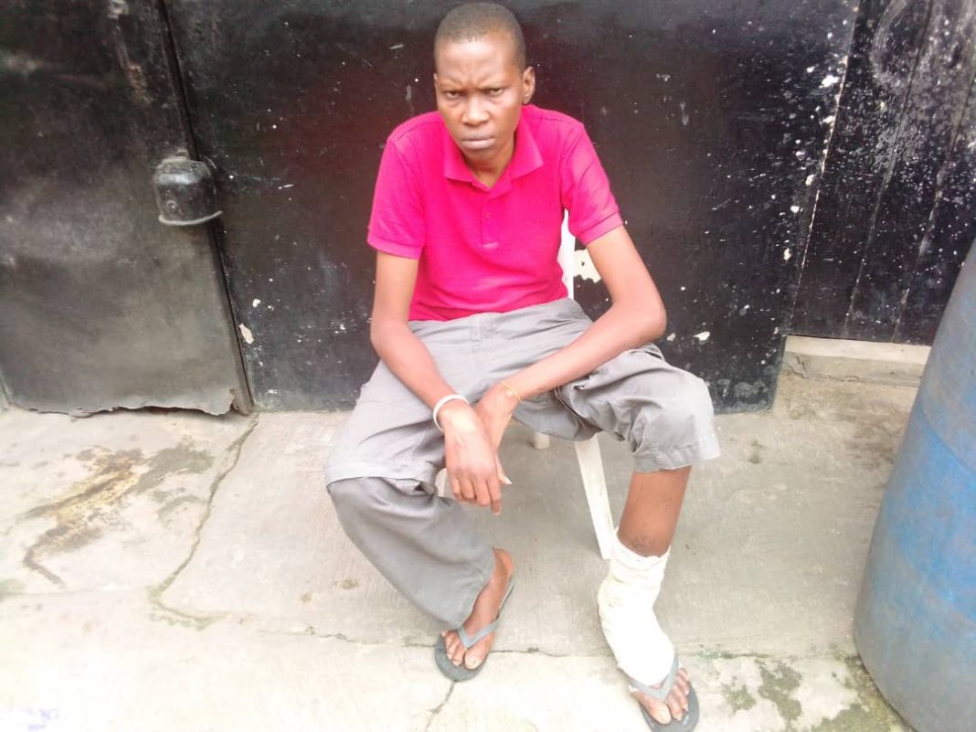 PDP grassroots Mobilizer seeks help to combat chronic leg ulcer