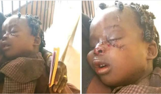 Horror: Headmistress rescues child from ritualists attempting to pluck off eyes