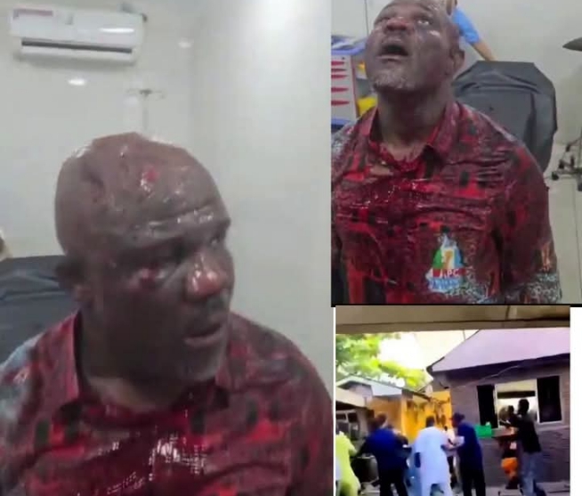 Tension! Delta Gov’s aide beaten up for promoting Tinubu’s govt as “best thing…”